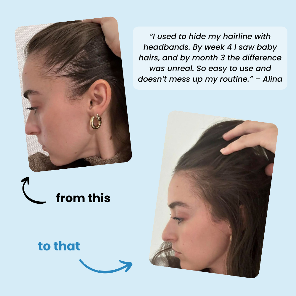 Advanced Hair Growth Serum Roll-On